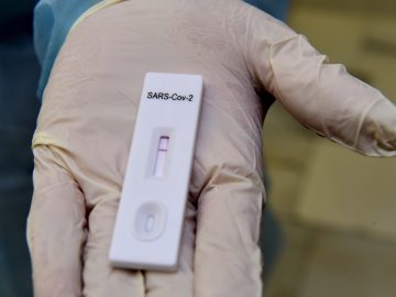 Přehled a porovnání antigenních testů na COVID-19